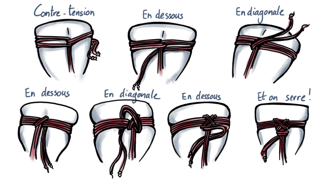 Friction en X ou en 8.png